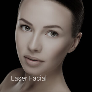 laser facial